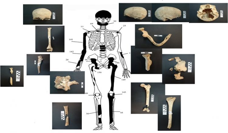 Πέντε οι σκελετοί της Αμφίπολης – Ανήκει ο ένας στην Ολυμπιάδα;