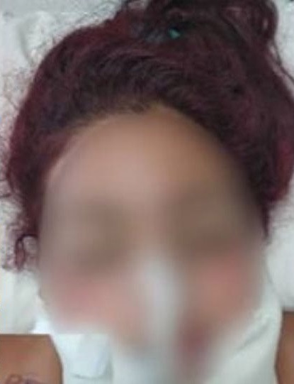 Αναγνωρίστηκε η 22χρονη που έπεσε θύμα ομαδικού βιασμού στο Ζεφύρι
