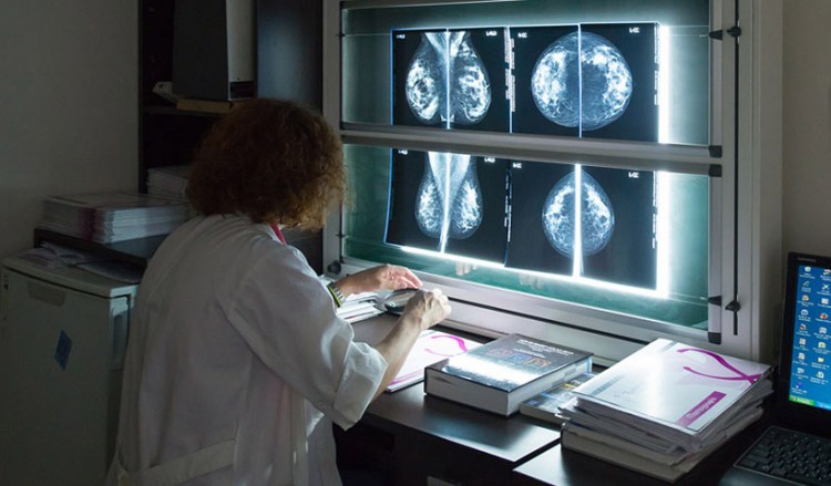 Καρκίνος του μαστού: Έλληνες και ξένοι επιστήμονες έκαναν πρόοδο σε θεραπεία με αναστολείς της πρωτεΐνης LMTK3