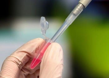 Ο Ηλίας Μόσιαλος για τη διακοπή των κλινικών δοκιμών του εμβολίου της AstraZeneca