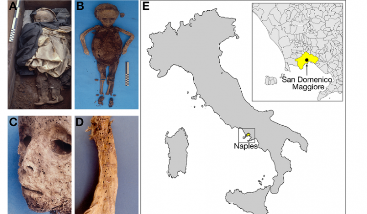 Ανακαλύφθηκε ηπατίτιδα Β στη μεσαιωνική μούμια παιδιού