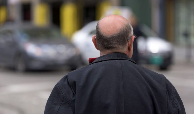 Η ατμοσφαιρική ρύπανση συνδέεται με την απώλεια μαλλιών