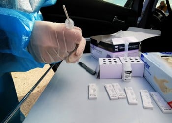 Γεγονός το πρώτο ελληνικό rapid test για τον κορονοϊό